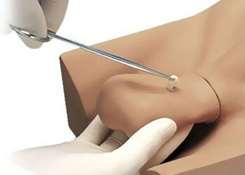 vasectomia-e1563802075951